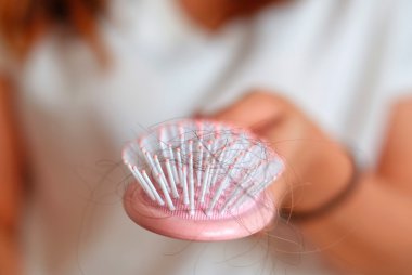 pandemic hair loss