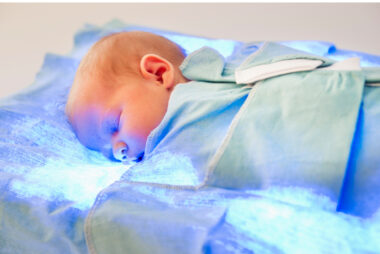 jaundice