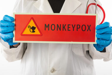 monkeypox