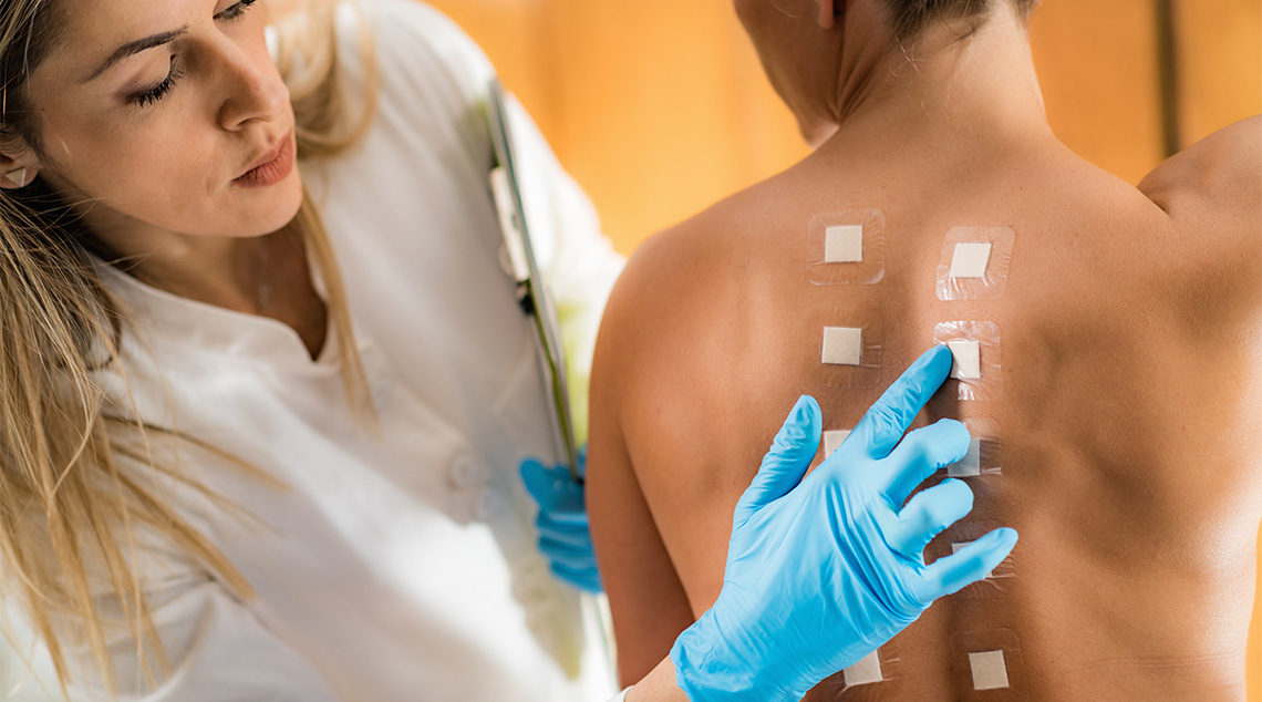 allergy-tests